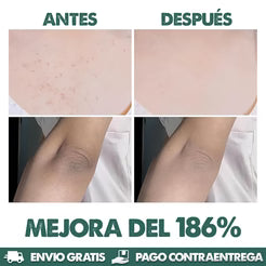 EXFOLIANTE DR MELAXIN PARA ACLARAR PARTES OSCURAS - FORMULA CURCUMA